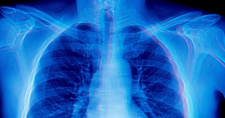 Futurism: Frontier AI models are doing something bizarre when asked to diagnose medical X-rays