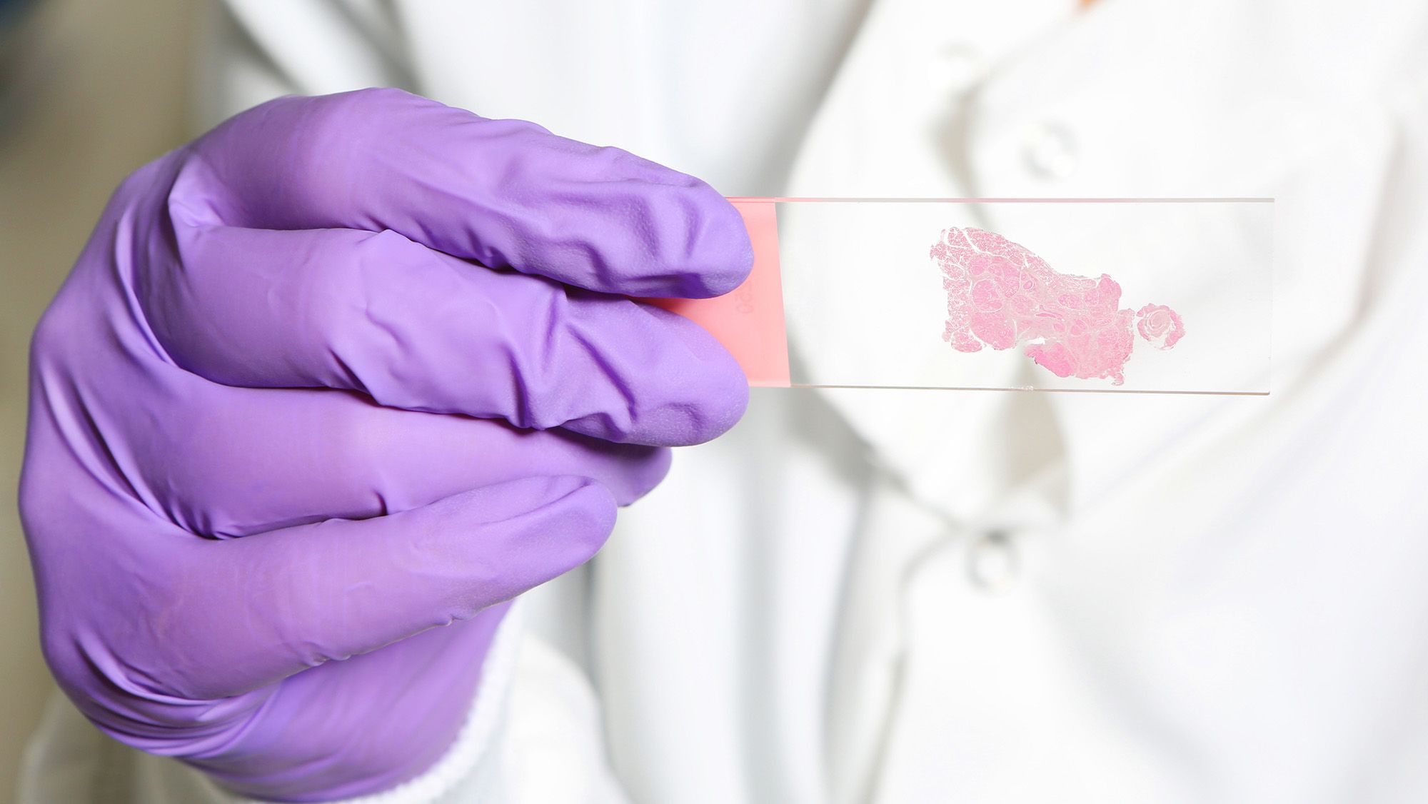 Live Science: AI trained to 'think' like human pathologists may be better at spotting cancer
