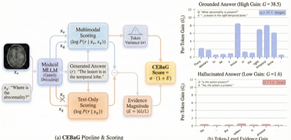 Deterministic Hallucination Detection in Medical VQA via Confidence-Evidence Bayesian Gain